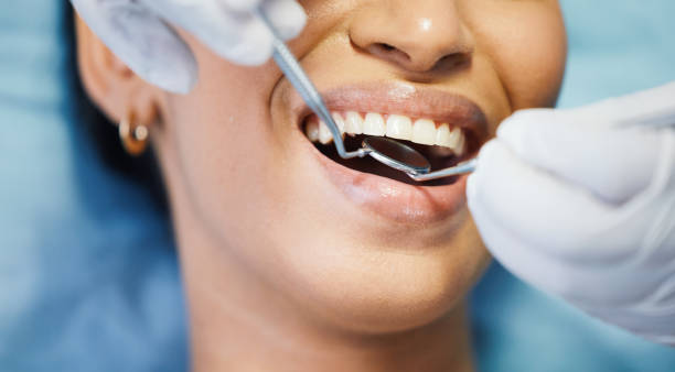 Best Urgent Care for Lost Fillings or Crowns in Box Elder, SD