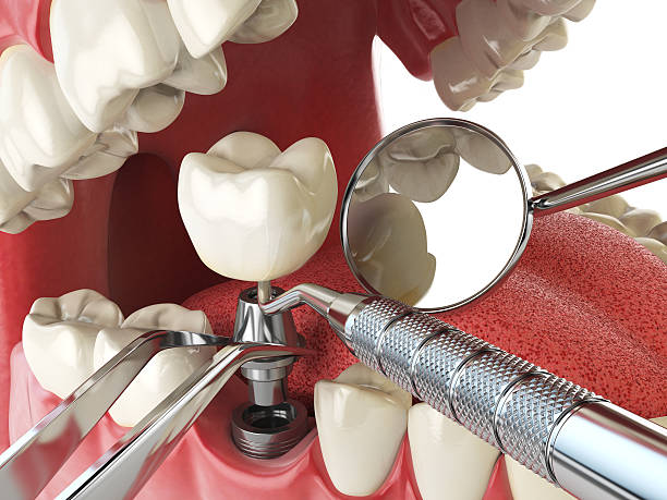 Best Emergency Denture Repair in Box Elder, SD
